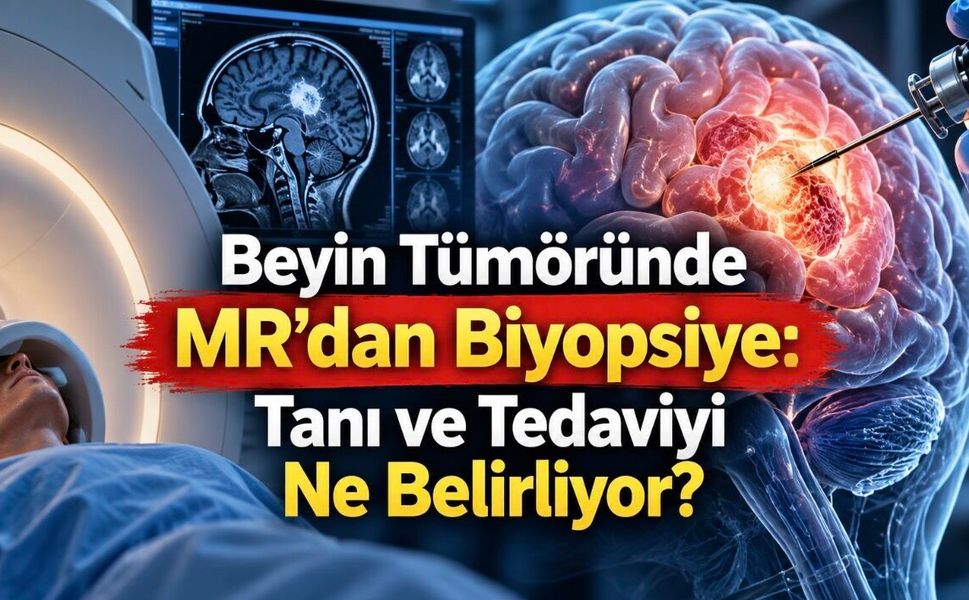 Beyin Tümörü Tanısı Nasıl Konur, Hangi Testler Yapılır ve Nasıl Tedavi Edilir?
