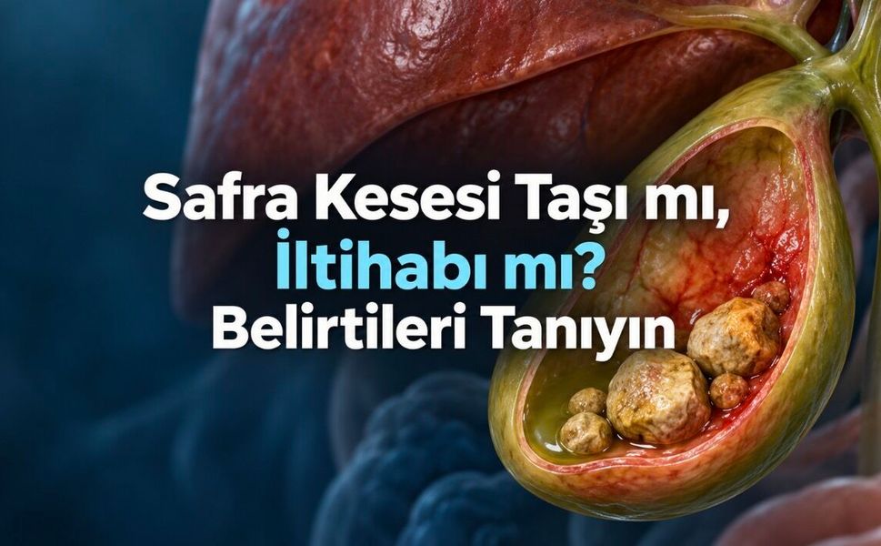 Safra kesesi taşı ve iltihabının belirtileri: Karın, omuz ağrısı ve acil uyarılar