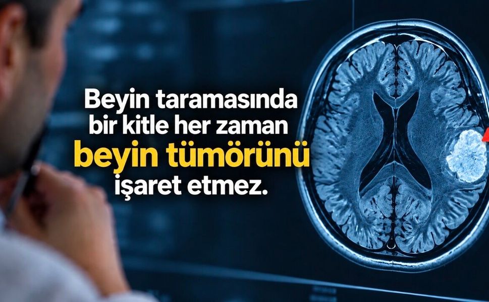Beyin MR’ında beyaz lekeler ne anlama gelir? Nedenleri ve önemli işaretler
