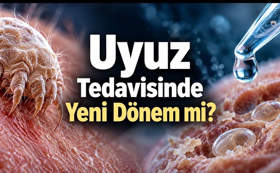 Uyuz paraziti ve yumurtaları deneysel tedaviyle ortadan kaldırıldı