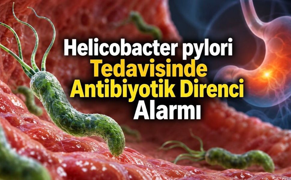 Helicobacter pylori Neden Tedaviye Direnç Gösteriyor? BMJ’den Önemli Değerlendirme