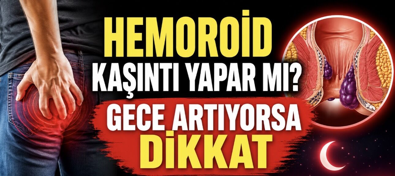 Hemoroid Kaşıntı Yapar mı? Uzmanlar Uyardı: Her Kaşıntının Nedeni Hemoroid Değil