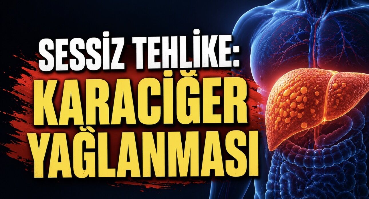 Karaciğer Yağlanmasının Tedavisi Var mı? Uzmanlardan “Geri Döndürülebilir” Uyarısı