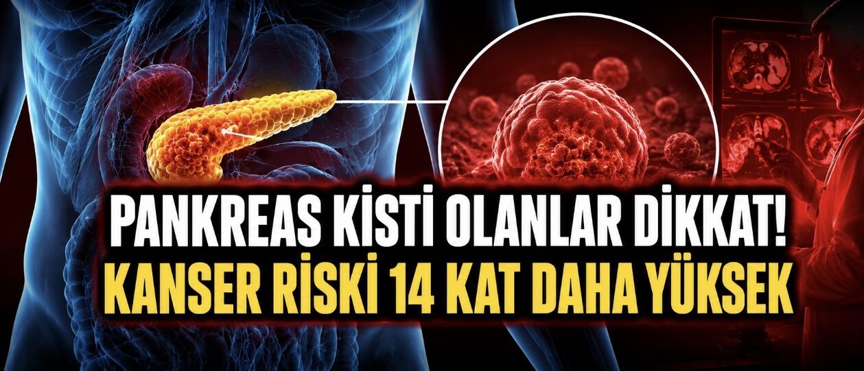 Pankreas Kistlerinde Uzun Takip Uyarısı: Kanser Riski Sanılandan Yüksek Çıktı