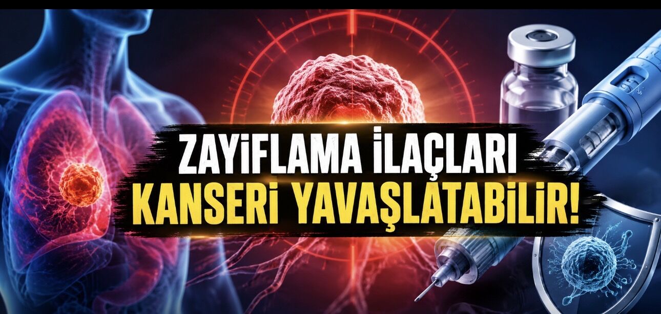 Zayıflama İlaçlarında Şaşırtan Etki: Kanserin İlerlemesini Yavaşlatabilir