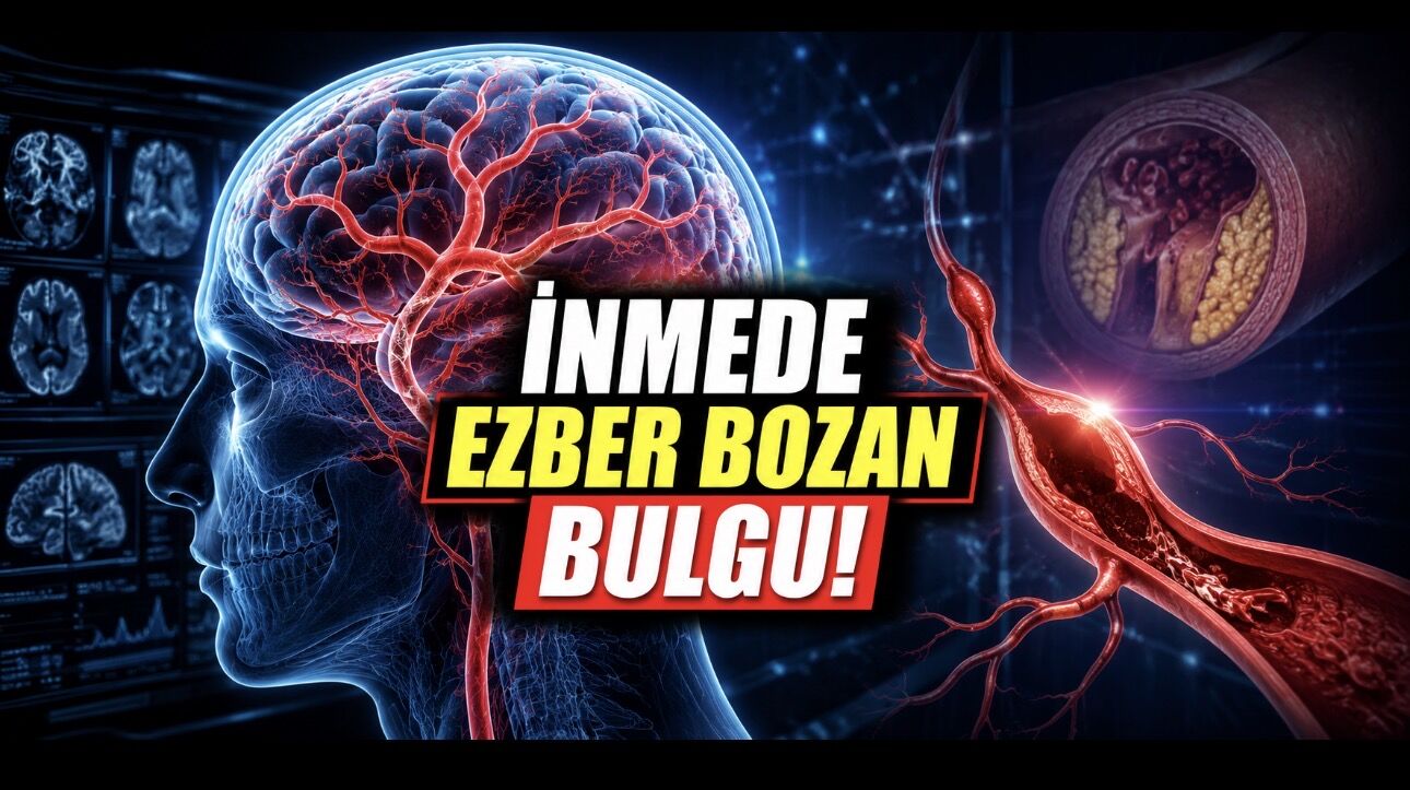 Beyin Damarlarında Ezber Bozan Bulgular: İnmede Tıkanıklık Değil Genişleme Öne Çıktı