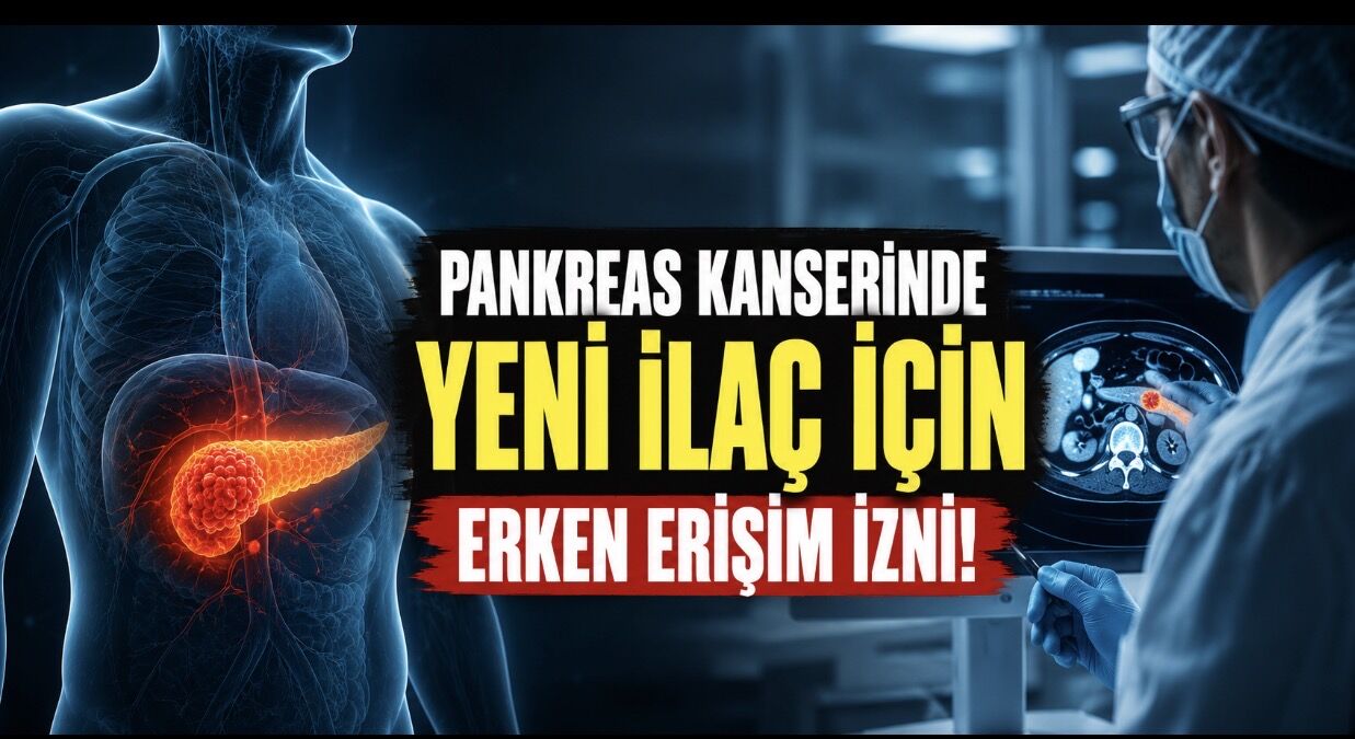 Pankreas Kanserinde Yeni Umut: Deneysel İlaca Erken Erişim İzni
