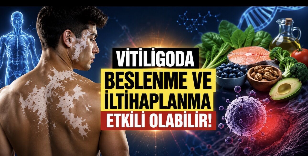 Vitiligoda Yeni Bulgular: Beslenme ve İltihaplanma Hastalığın İlerlemesinde Rol Oynayabilir