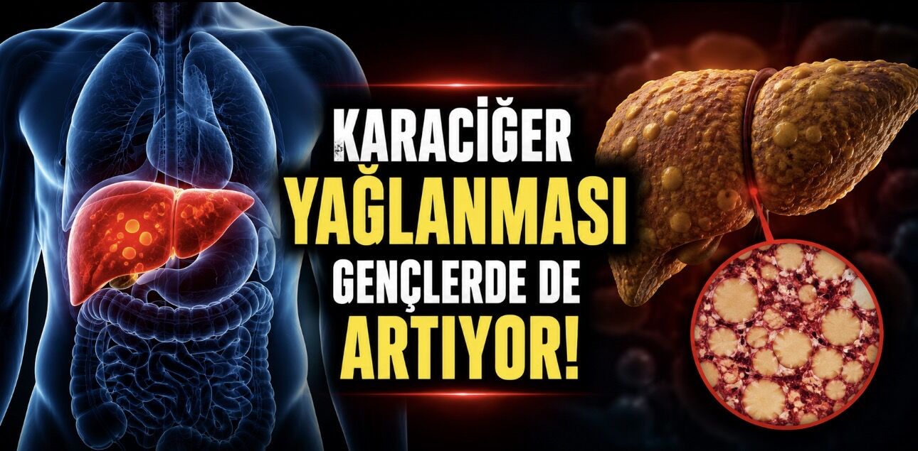 Sessiz Tehlike: Karaciğer Yağlanması Gençlerde de Artıyor