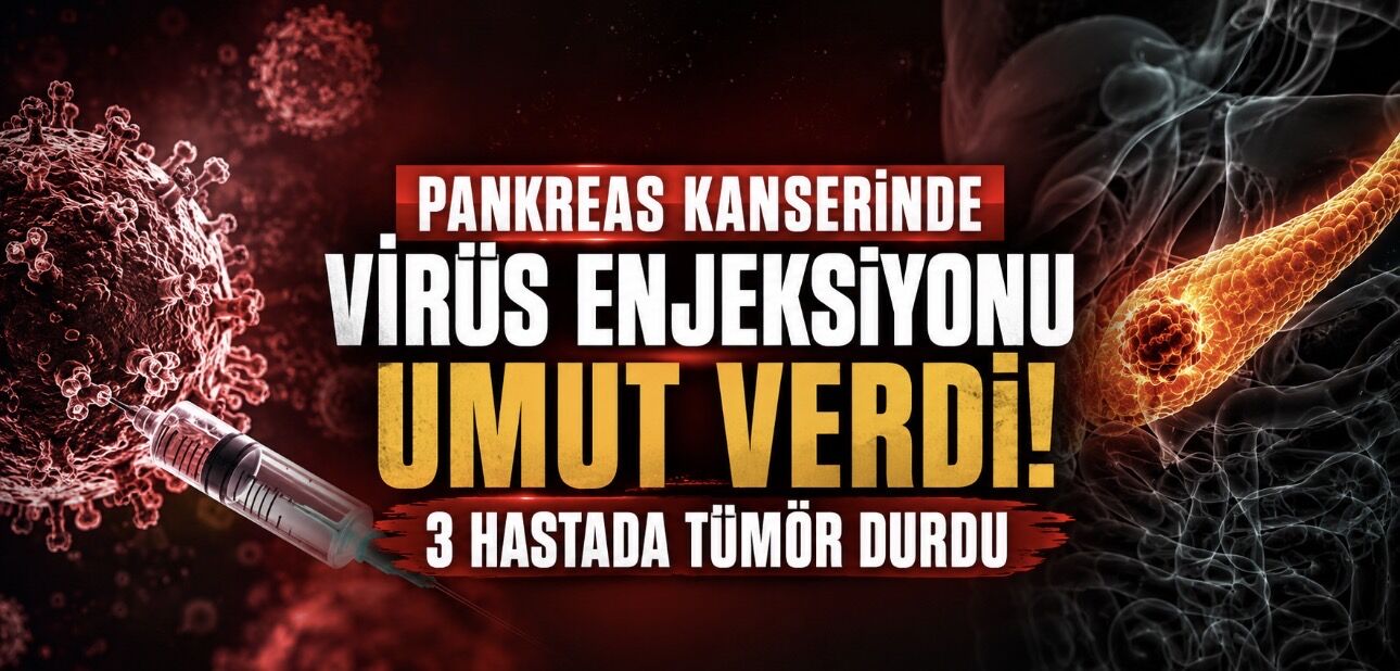 Pankreas Kanserinde Virüs Enjeksiyonu Umudu: Üç Hastada Tümör İlerlemesi Durdu