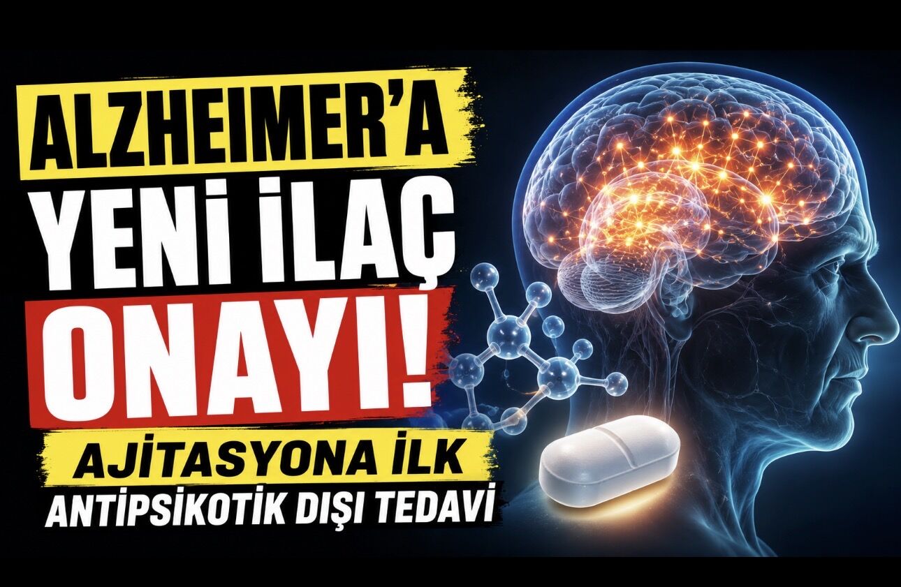 Alzheimer’da Yeni Dönem: Ajitasyon İçin Antipsikotik Olmayan İlk İlaç Onaylandı