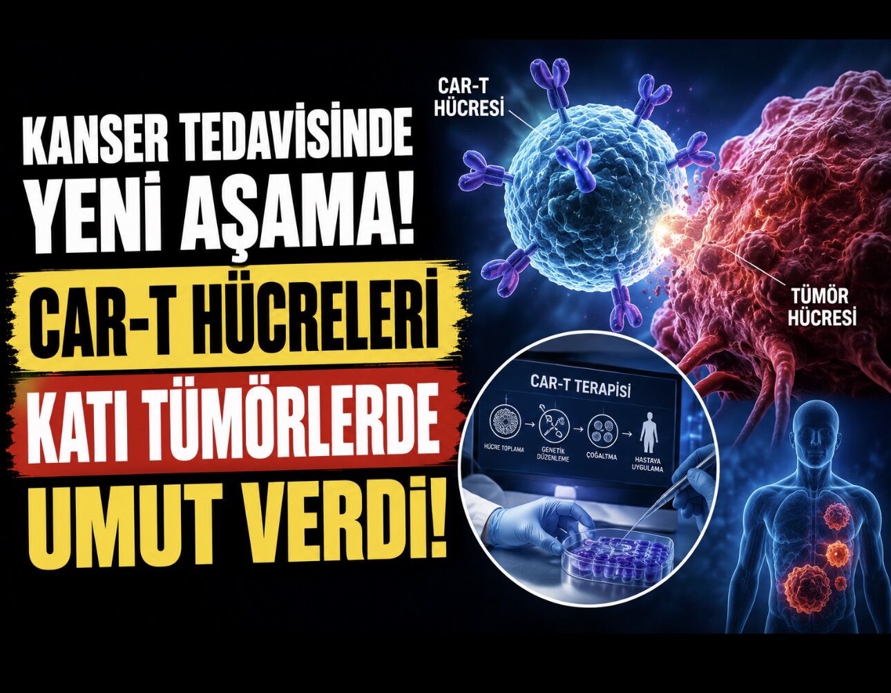 Kanser Tedavisinde Yeni Aşama: CAR-T Hücreleri Katı Tümörlerde Umut Verdi