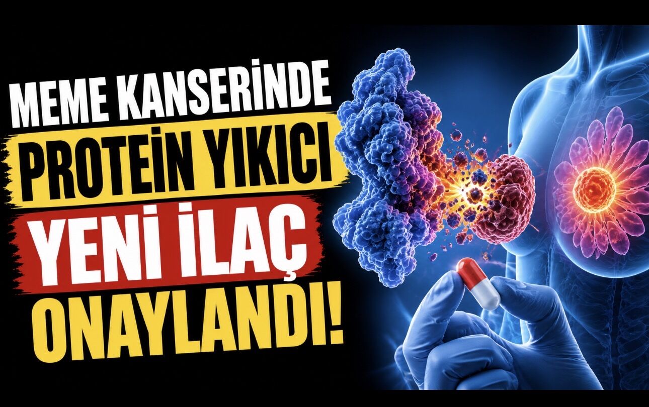Meme Kanserinde Yeni Dönem: “Protein Yıkıcı” İlaç Onayı Geldi