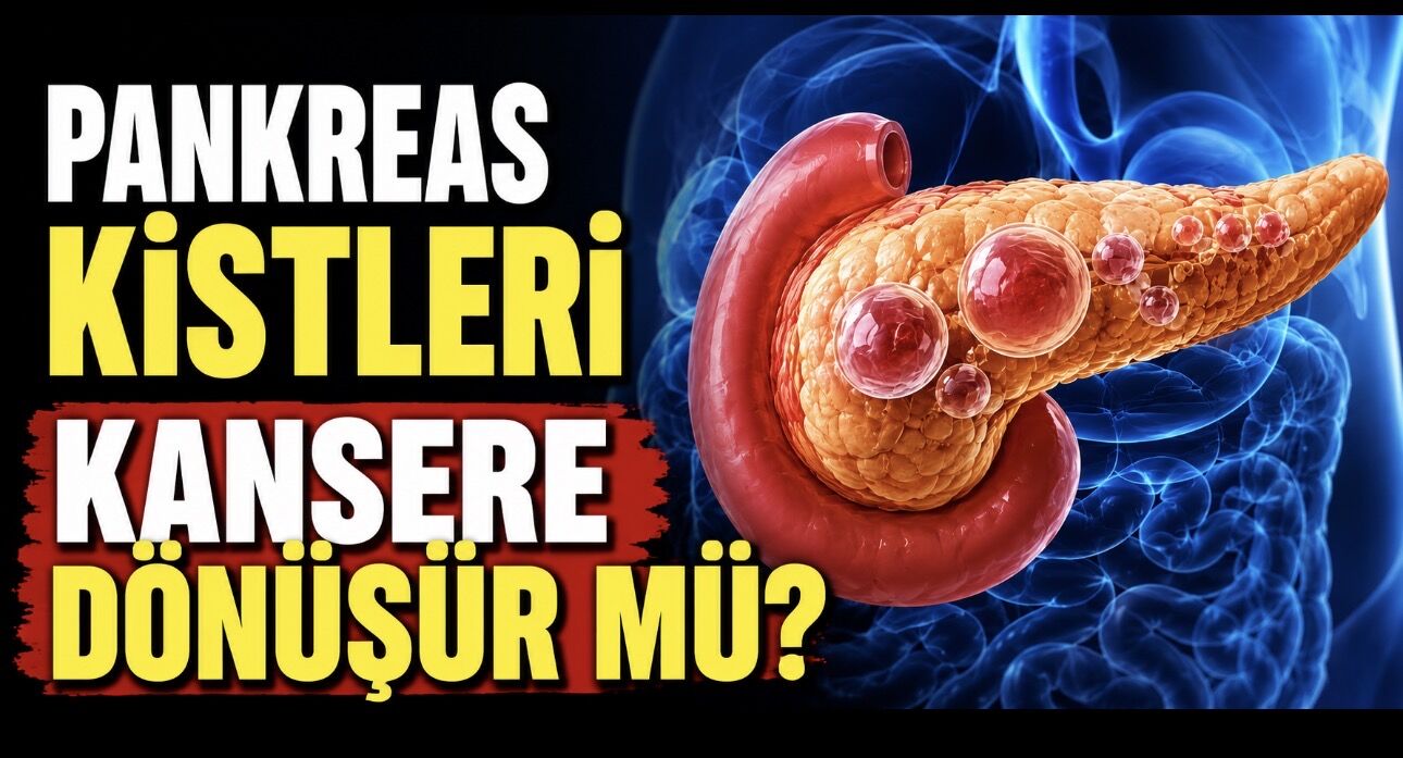 Pankreas Kistleri Kansere Dönüşür mü? Belirti, Takip ve Tedavi Süreci