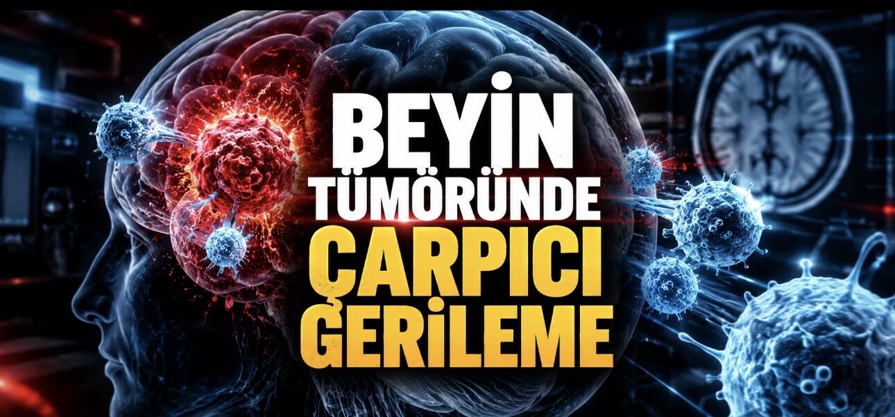 Deneysel CAR-T Tedavisi Beyin Tümöründe Günler İçinde Küçülme Sağladı