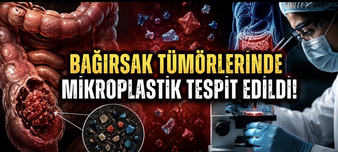 Bağırsak Tümörlerinde Mikroplastik İzleri: Nature Health’ten Dikkat Çeken Çalışma