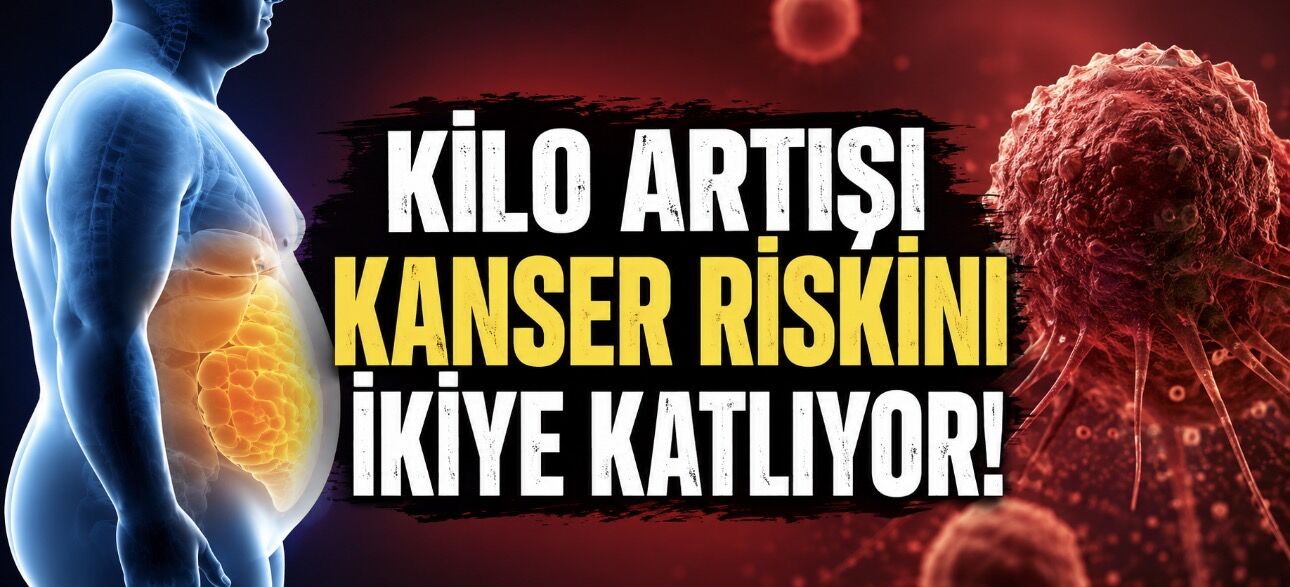 Yetişkinlikte Kilo Artışı Bazı Kanserlerde Riski İkiye Katlayabiliyor