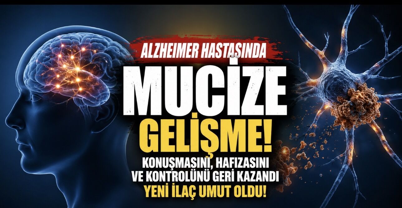 Alzheimer Hastası Konuşma ve Hafıza Yetilerini Geri Kazandı: Yeni İlaç Umut Verdi