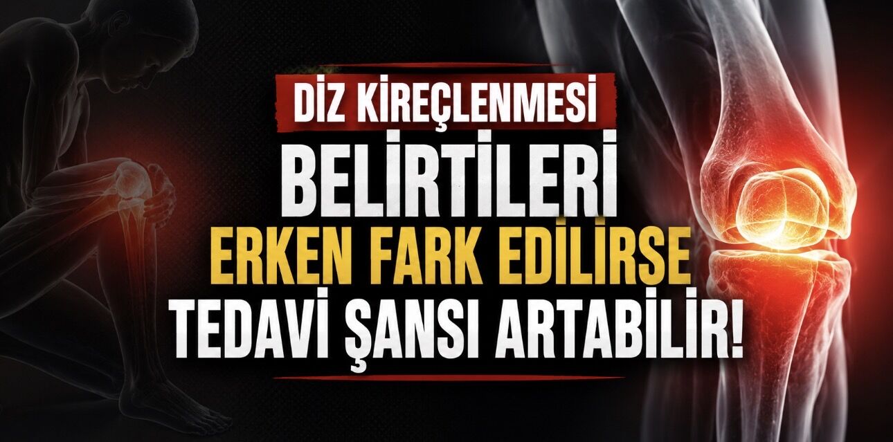 Diz Kireçlenmesi Belirtileri Erken Fark Edilirse Tedavi Şansı Artabilir