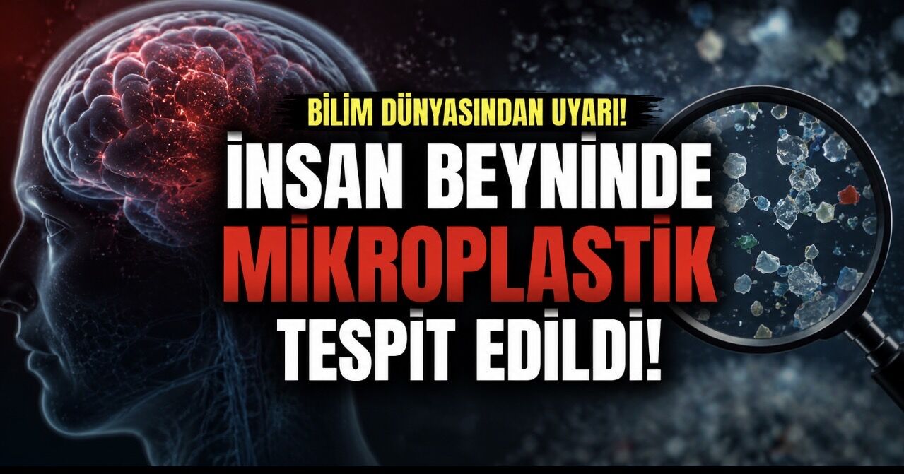 İnsan beyninde mikroplastik alarmı: Demans hastalarında daha yüksek seviyeler bulundu