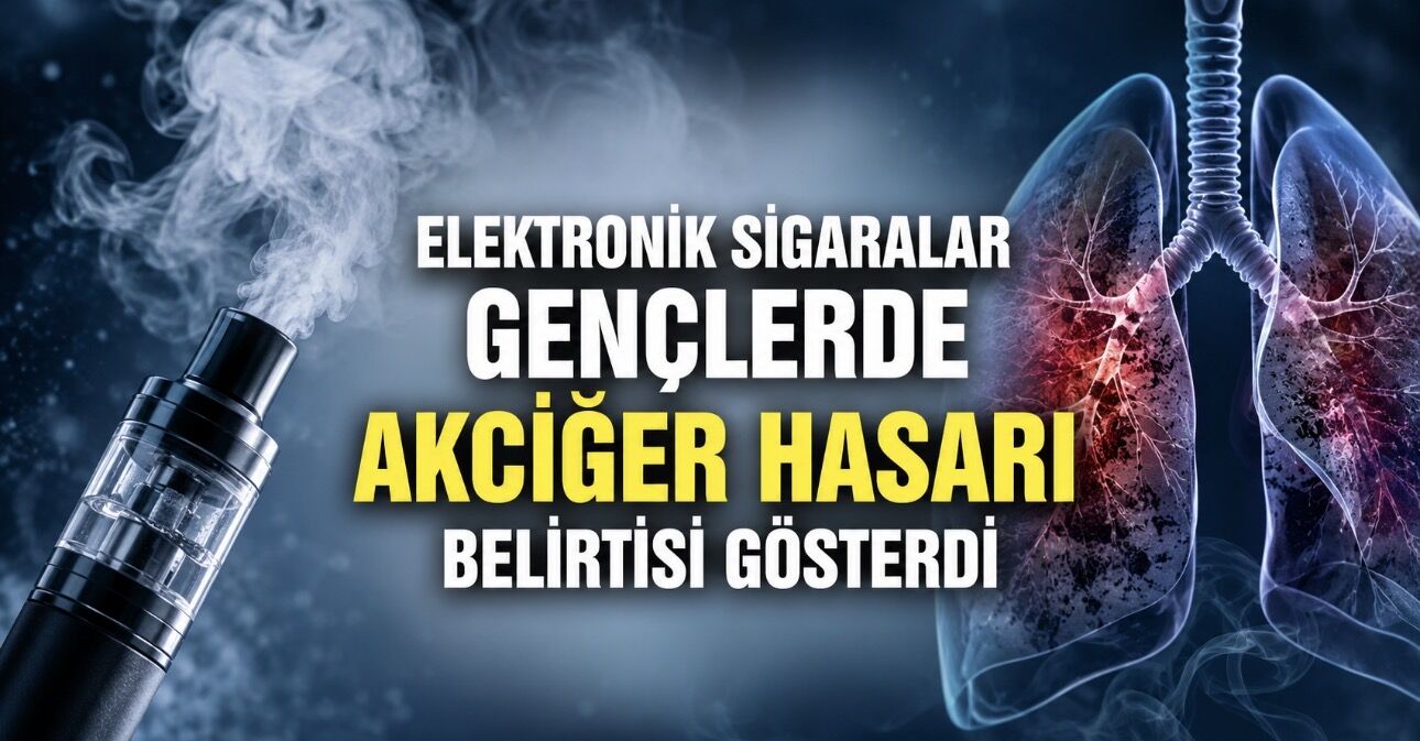 Elektronik Sigaralar Gençlerde Erken Akciğer Hasarı Belirtileri Gösterdi