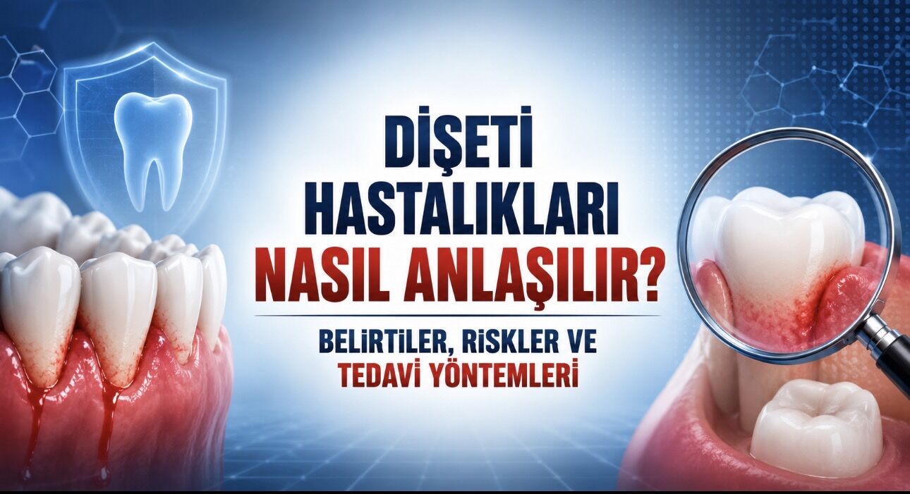 Dişeti Hastalıkları Nasıl Anlaşılır? Belirtiler, Tedavi ve Riskler