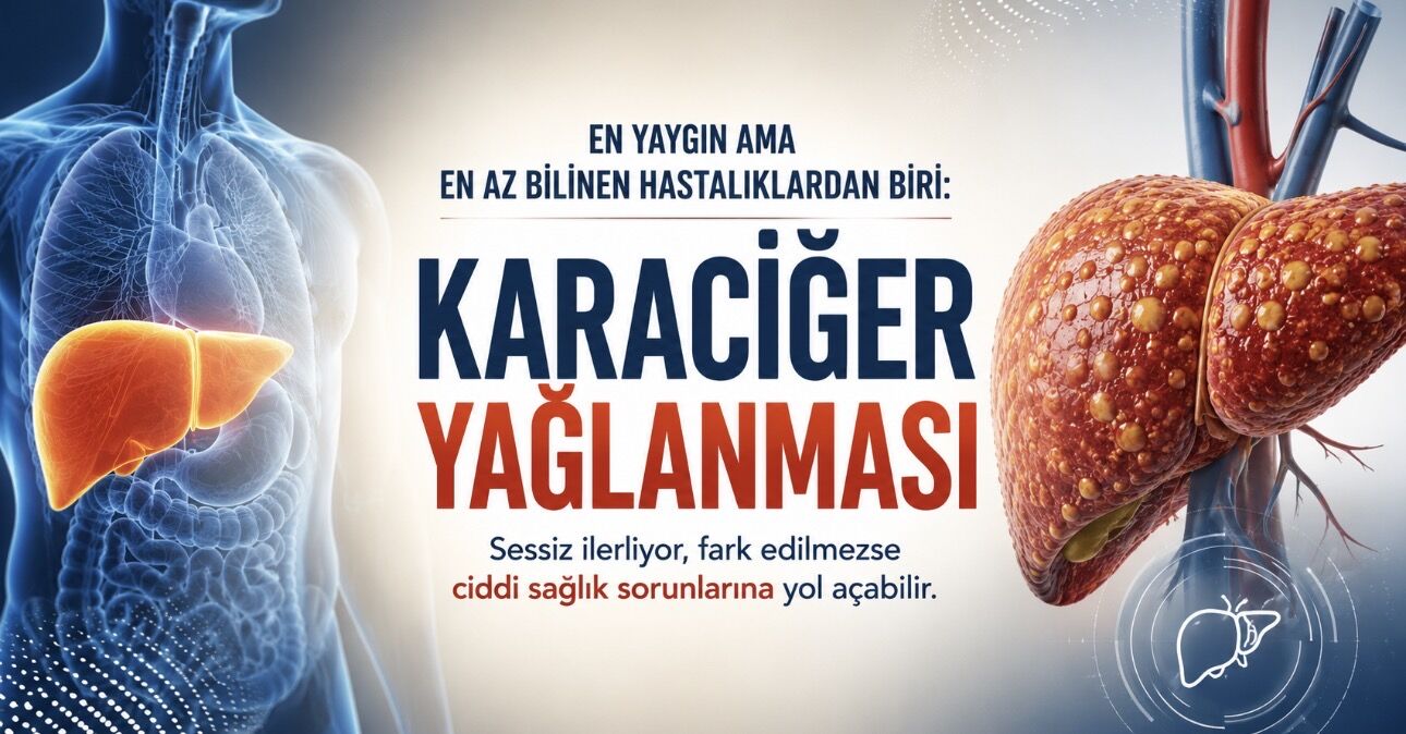 En Yaygın Ama En Az Bilinen Hastalıklardan Biri: Karaciğer Yağlanması