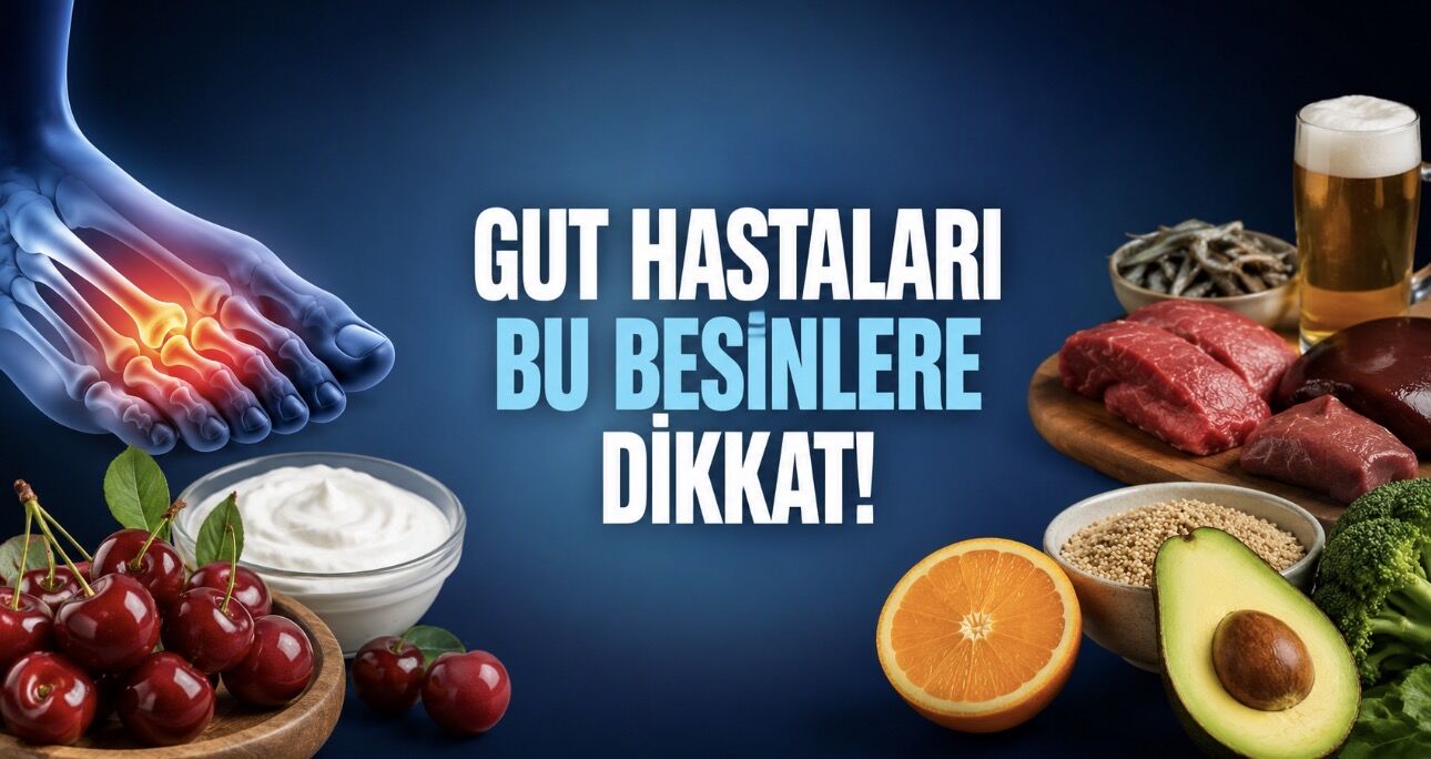 Gut Hastaları İçin Beslenme Rehberi: Bu Gıdalar Atak Riskini Azaltabilir