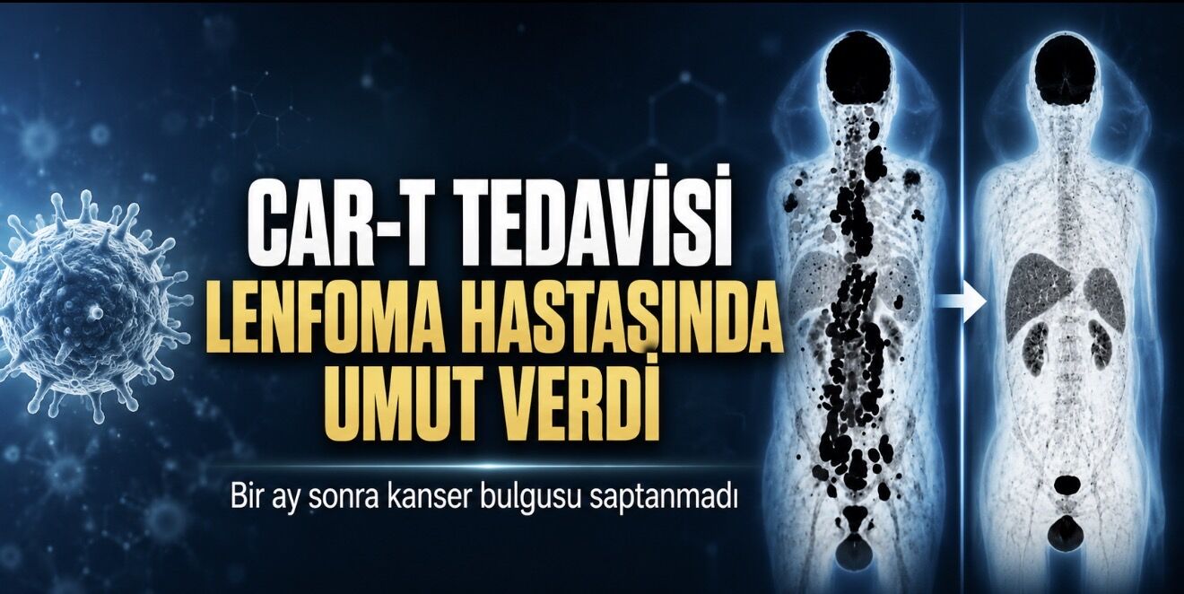 CAR-T Tedavisi Sonrası Lenfoma Hastasında Kanser Bulgusu Kalmadı