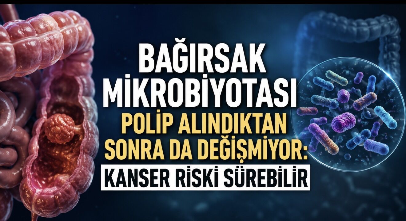 Bağırsak Mikrobiyotası Polip Alındıktan Sonra da Değişmiyor: Kanser Riski Sürebilir