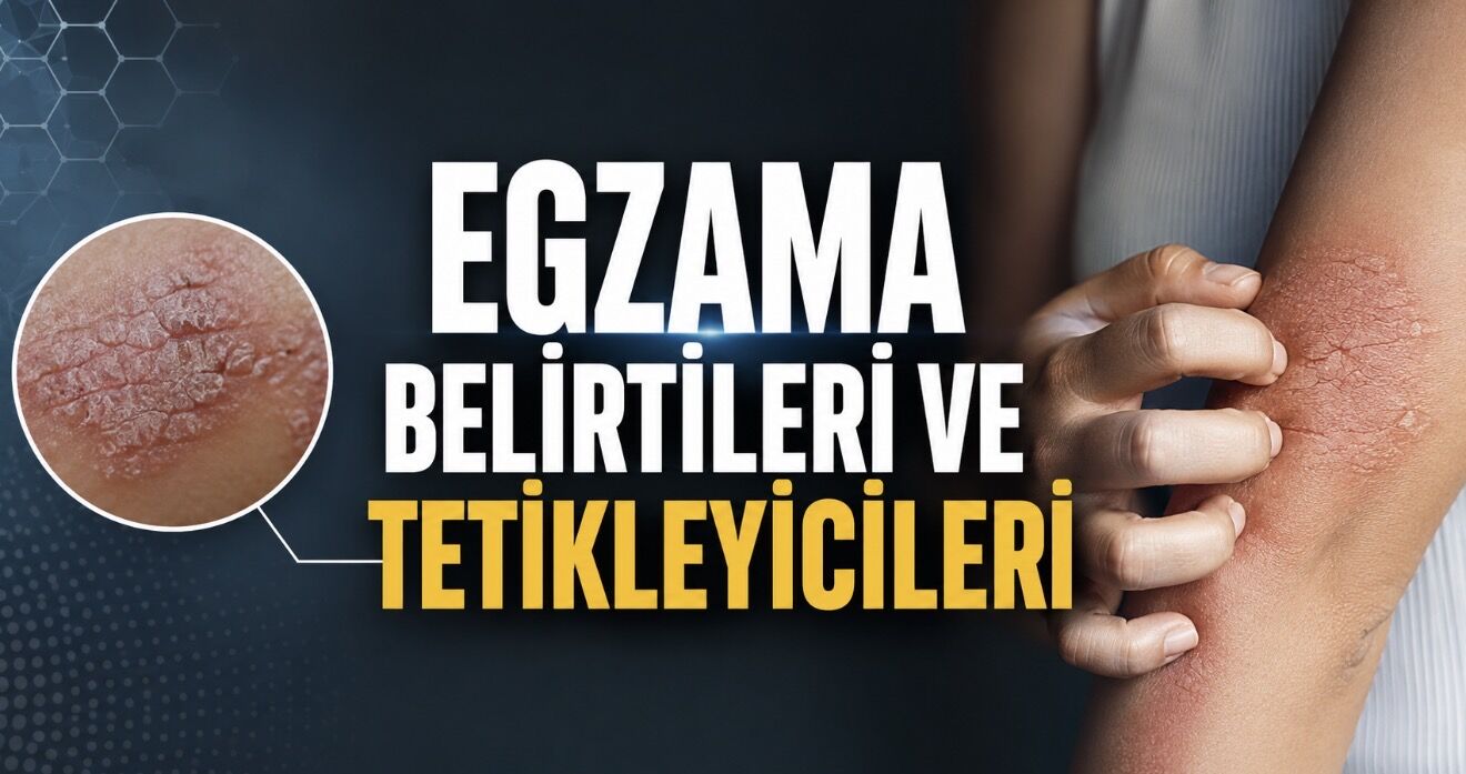 Egzama belirtileri, nedenleri ve tedavisi hakkında bilinmesi gerekenler