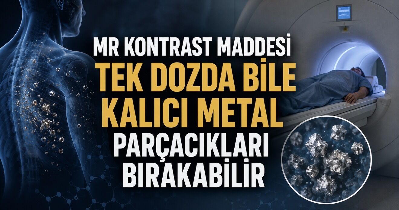MR Kontrast Maddesi Tek Dozda Bile Kalıcı Metal Parçacıkları Bırakabilir