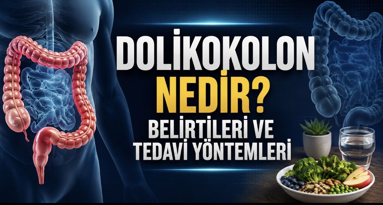 Dolikokolon Nedir? Belirtileri, Nedenleri ve Tedavi Yöntemleri